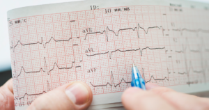 ELEKTROKARDİYOGRAFİ (EKG)